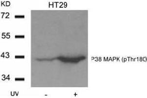 Image no. 1 for anti-Mitogen-Activated Protein Kinase 14 (MAPK14) (pThr180) antibody (ABIN197010) (MAPK14 抗体  (pThr180))
