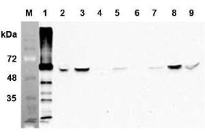 Western blot analysis of human FTO using anti-human FTO mAb (AG103)  at 1:1,000 dilution: 1. (FTO 抗体)