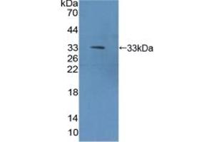 Detection of Recombinant METRN, Mouse using Polyclonal Antibody to Meteorin (METRN) (METRN 抗体  (AA 22-291))