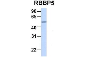 Host:  Rabbit  Target Name:  RBBP5  Sample Type:  Human Adult Placenta  Antibody Dilution:  1. (RBBP5 抗体  (Middle Region))