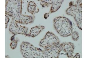Image no. 3 for anti-Far Upstream Element (FUSE) Binding Protein 1 (FUBP1) (AA 27-137) antibody (ABIN599075) (FUBP1 抗体  (AA 27-137))
