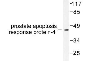 Image no. 1 for anti-PRKC, Apoptosis, WT1, Regulator (PAWR) antibody (ABIN271791) (PAWR 抗体)