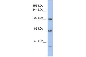 WB Suggested Anti-TPCN1 Antibody Titration:  0. (TPCN1 抗体  (N-Term))