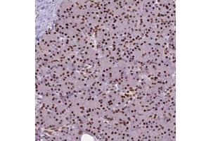 Immunohistochemical staining (Formalin-fixed paraffin-embedded sections) of human pancreas with AKAP8 polyclonal antibody  shows strong nuclear positivity in exocrine glandular cells.