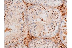 Immunohistochemistry (IHC) image for anti-Forkhead Box O4 (FOXO4) (pThr451) antibody (ABIN6256565)
