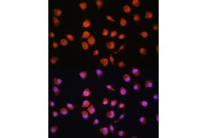 Immunofluorescence analysis of L929 cells using NPLOC4 Rabbit pAb (ABIN1681086, ABIN5664262, ABIN5664264 and ABIN6220175) at dilution of 1:100. (NPLOC4 抗体  (AA 1-270))