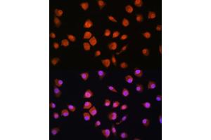 Immunofluorescence analysis of L929 cells using NPLOC4 Rabbit pAb (ABIN1681086, ABIN5664262, ABIN5664264 and ABIN6220175) at dilution of 1:100. (NPLOC4 抗体  (AA 1-270))
