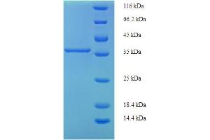 PIGX Protein (AA 42-230, partial) (His-SUMO Tag)