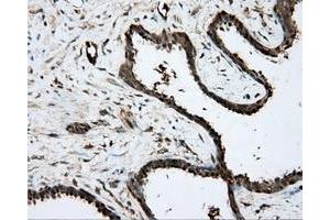 Immunohistochemistry (IHC) image for anti-Protein Kinase, CAMP-Dependent, Regulatory, Type II, alpha (PRKAR2A) antibody (ABIN1500256) (PRKAR2A 抗体)