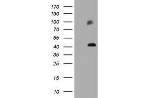 Image no. 2 for anti-Melanoma Antigen Family A, 3 (MAGEA3) antibody (ABIN1499253) (MAGEA3 抗体)