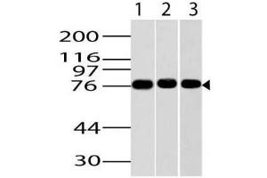 Image no. 1 for Goat anti-Mouse IgG antibody (HRP) (ABIN5027922) (山羊 anti-小鼠 IgG Antibody (HRP))