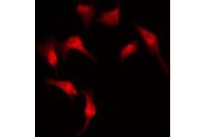 ABIN6273930 staining COLO205 by IF/ICC. (GPR176 抗体  (C-Term))