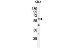 Western blot analysis of USP2 polyclonal antibody  in K-562 cell line lysates (35 ug/lane). (USP2 抗体  (C-Term))