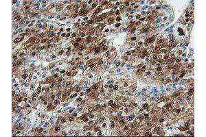 Image no. 4 for anti-Aminoacylase 1 (ACY1) antibody (ABIN1496456) (Aminoacylase 1 抗体)