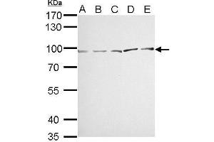WB Image MVP/LRP antibody detects MVP protein by Western blot analysis. (MVP 抗体)