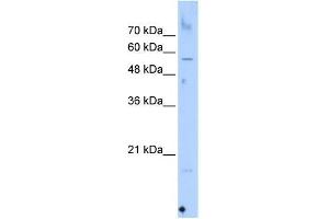 Western Blot showing SEPN1 antibody used at a concentration of 1-2 ug/ml to detect its target protein. (SEPN1 抗体  (C-Term))