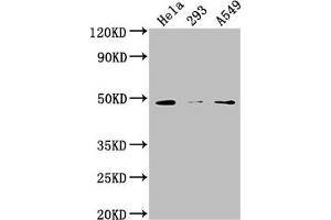 Western Blot Positive WB detected in: Hela whole cell lysate, 293 whole cell lysate, A549 whole cell lysate All lanes: NXN antibody at 1:2000 Secondary Goat polyclonal to rabbit IgG at 1/50000 dilution Predicted band size: 49, 21, 37 kDa Observed band size: 49 kDa (NXN 抗体  (AA 155-435))