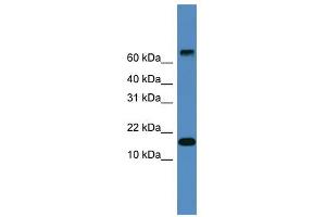 WB Suggested Anti-CST9 Antibody Titration: 0. (CST9 抗体  (Middle Region))