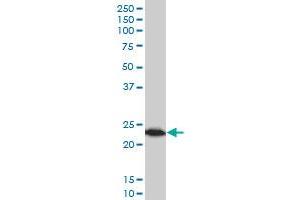 TPT1 monoclonal antibody (M03), clone 2C4 Western Blot analysis of TPT1 expression in MCF-7 .