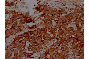Immunohistochemistry (IHC) image for anti-Inhibitor of kappa Light Polypeptide Gene Enhancer in B-Cells, Kinase beta (IKBKB) antibody (ABIN7127566)