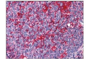 Human Tonsil: Formalin-Fixed, Paraffin-Embedded (FFPE) (ARL6IP5 抗体  (C-Term))