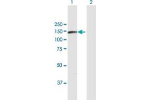 Western Blotting (WB) image for anti-Eukaryotic Translation Initiation Factor 4E Nuclear Import Factor 1 (EIF4ENIF1) (AA 1-985) antibody (ABIN949504)