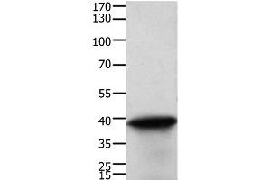 Western Blot analysis of Human cervical cancer tissue using TPM2 Polyclonal Antibody at dilution of 1:600 (TPM2 抗体)