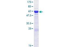 Image no. 1 for Small Glutamine-Rich Tetratricopeptide Repeat (TPR)-Containing, beta (SGTB) (AA 1-304) protein (GST tag) (ABIN1319853) (SGTB Protein (AA 1-304) (GST tag))