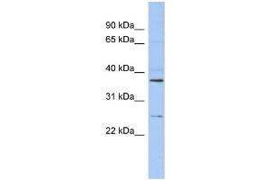 WB Suggested Anti-ZFAND6 Antibody Titration: 0. (ZFAND6 抗体  (Middle Region))