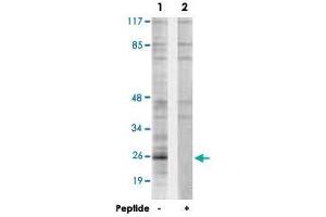 Western blot analysis of extracts from Jurkat cells, using PPP1R2 polyclonal antibody . (PPP1R2 抗体  (Ser120, Ser121))