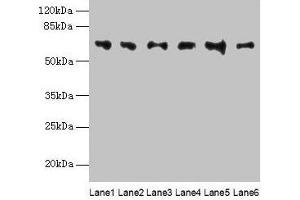 Western blot All lanes: FBXO24 antibody at 1 μg/mL Lane 1: Mouse gonadal tissue Lane 2: Mouse kidney tissue Lane 3: A549 whole cell lysate Lane 4: 293T whole cell lysate Lane 5: Jurkat whole cell lysate Lane 6: MCF-7 whole cell lysate Secondary Goat polyclonal to rabbit IgG at 1/10000 dilution Predicted band size: 65, 37, 70, 64 kDa Observed band size: 65 kDa (FBXO24 抗体  (AA 1-200))