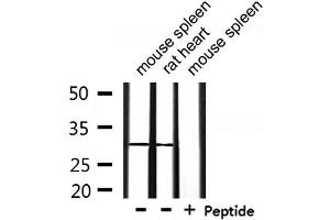 Western blot analysis of extracts from mouse spleen and rat heart, using OTUB1 Antibody. (OTUB1 抗体  (Internal Region))