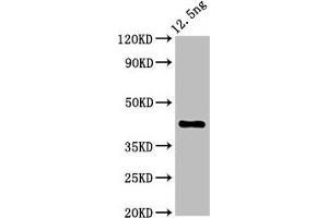 Western Blot Positive WB detected in Recombinant protein All lanes: ZAR1 antibody at 5.