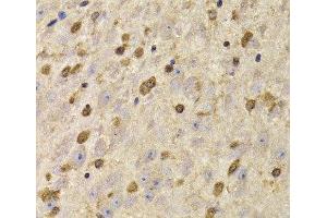 Immunohistochemistry of paraffin-embedded Mouse brain using QKI Polyclonal Antibody at dilution of 1:100 (40x lens). (QKI 抗体)