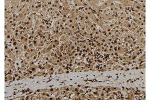 ABIN6279080 at 1/100 staining Human liver tissue by IHC-P. (ADAM33 抗体  (Internal Region))