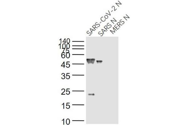 SARS-Coronavirus Nucleocapsid Protein (SARS-CoV N) 抗体