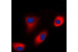 Immunofluorescent analysis of DAB1 staining in MCF7 cells. (DAB1 抗体  (Center))