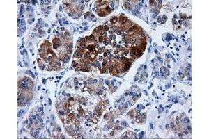 Immunohistochemistry (IHC) image for anti-Dicarbonyl/L-Xylulose Reductase (DCXR) antibody (ABIN1497784) (DCXR 抗体)