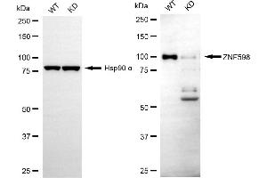Western blotting analysis using ZNF598 antibody (ABIN7800898). (ZNF598 抗体)