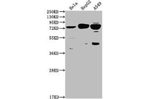Western Blot Positive WB detected in: Hela whole cell lysate, HepG2 whole cell lysate, A549 whole cell lysate All lanes: HTR2C antibody at 1:2000 Secondary Goat polyclonal to rabbit IgG at 1/50000 dilution Predicted band size: 52, 29 kDa Observed band size: 75 kDa (Recombinant HTR2C 抗体)
