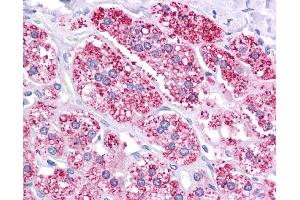 ABCB1 antibody was used for immunohistochemistry at a concentration of 4-8 ug/ml. (ABCB1 抗体)