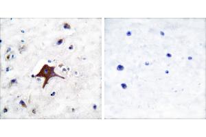 Peptide - +Immunohistochemical analysis of paraffin-embedded human brain tissue using GLUT3 antibody (#C0214). (SLC2A3 抗体)