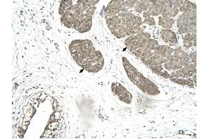 MORF4L1 antibody was used for immunohistochemistry at a concentration of 4-8 ug/ml to stain Smooth muscle cells (arrows) in Human urinary bladder.
