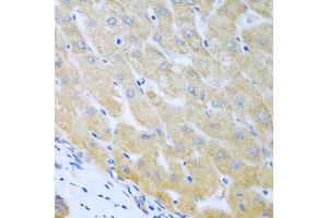 Immunohistochemistry of paraffin-embedded human liver using BECN1 antibody at dilution of 1:100 (40x lens). (Beclin 1 抗体)