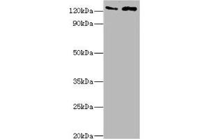 Western blot All lanes: KDM4B antibody at 4 μg/mL Lane 1: Jurkat whole cell lysate Lane 2: k562 whole cell lysate Secondary Goat polyclonal to rabbit IgG at 1/10000 dilution Predicted band size: 122, 51 kDa Observed band size: 122 kDa (KDM4B 抗体  (AA 1-260))