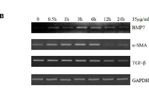Western Blotting (WB) image for anti-Actin, alpha 2, Smooth Muscle, Aorta (ACTA2) (N-Term) antibody (ABIN2857027)
