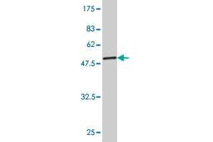 Western Blot detection against Immunogen (53. (TPI1 抗体  (AA 1-249))