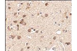 Immunohistochemistry of Stk39 in human brain tissue with this product at 2. (STK39 抗体  (Center))