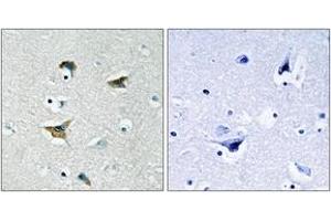Immunohistochemistry analysis of paraffin-embedded human brain tissue, using FAK (Ab-397) Antibody. (FAK 抗体  (AA 363-412))