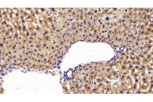 Immunohistochemistry (IHC) image for anti-Alanine Aminotransferase (ALT) (AA 143-417) antibody (ABIN7429412)